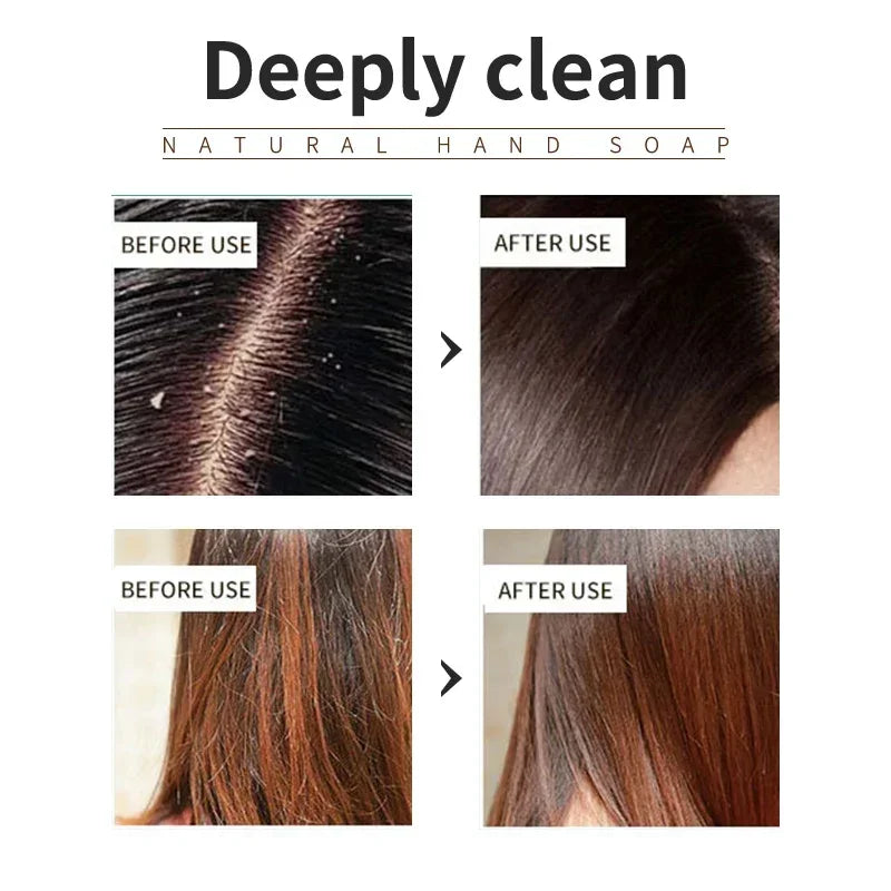 Everstead lavender Shampoo Is Refreshing, Oil Controlling, and Smooth for Hair, Solving the Problem of Oily Scalp Without Silicone Oil Res